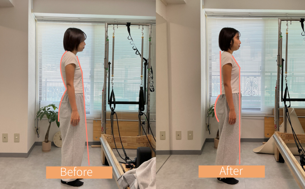 30代 S様(週1回)
後ろよりの姿勢がまっすぐに。お尻もヒップアップし、さらに巻き肩も改善