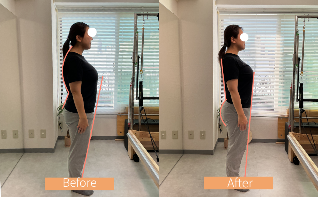 40代 T様(週1回)
首の向き、反り腰、猫背が改善し、お尻もヒップアップ。さらに太もも前もスッキリ